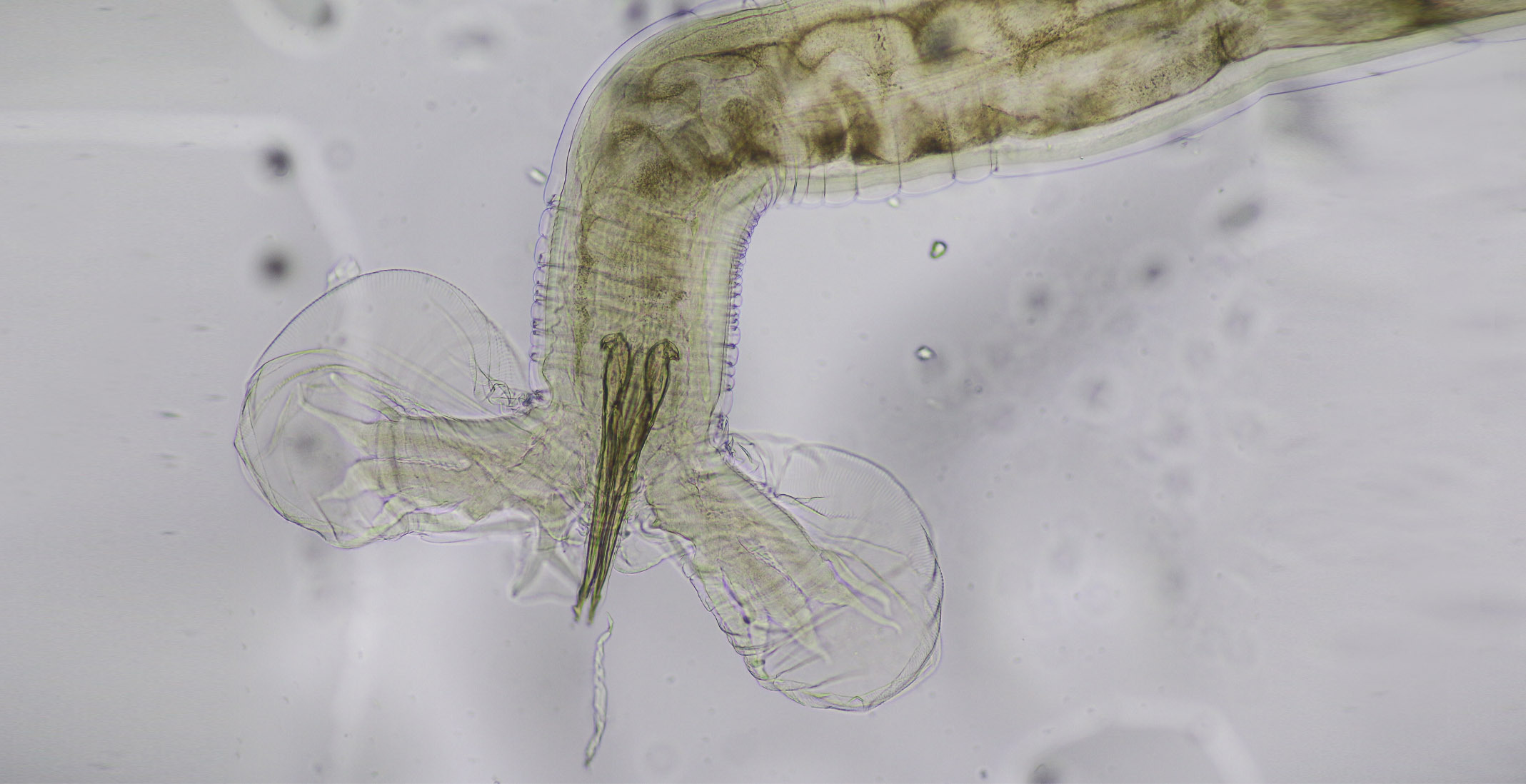Bio Zoo Haemonchus Contortus Bajo El Microscopio