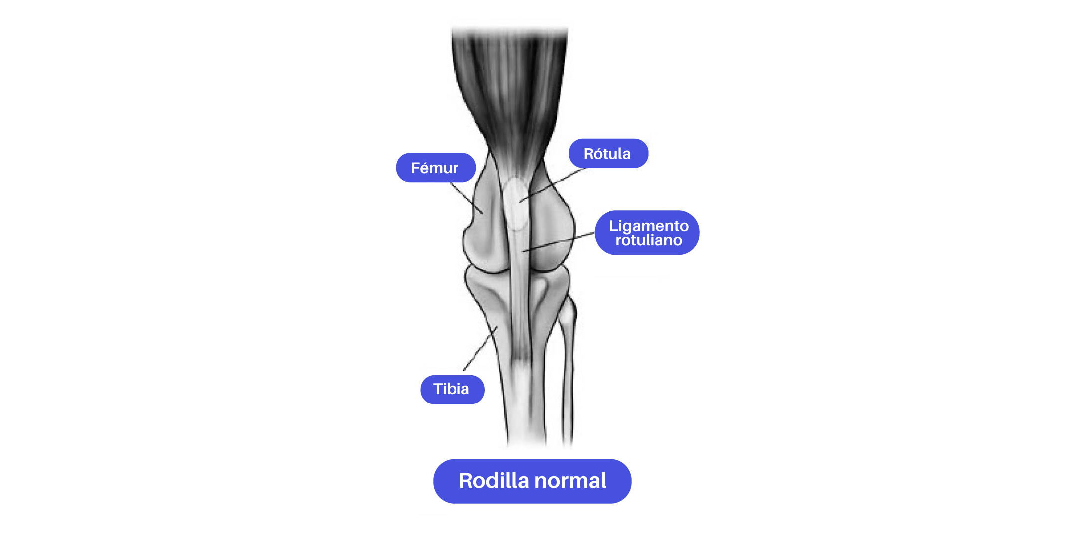 Bio Zoo Rodilla Normal